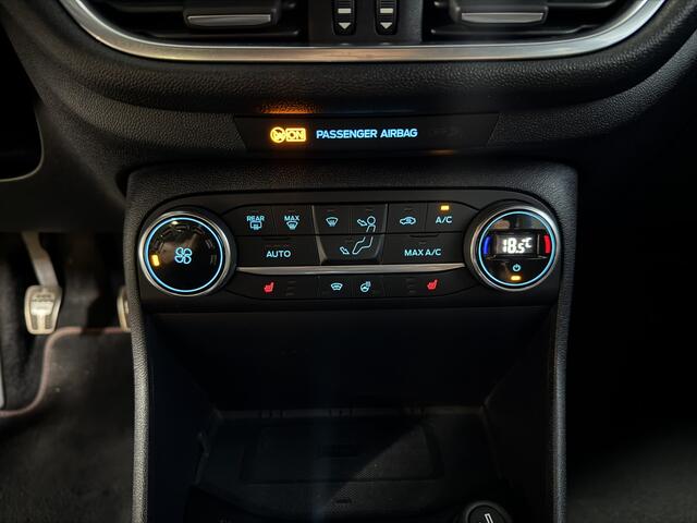 Ford FIESTA 1.0 EcoBoost Hybrid ST-Line X