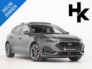 ford-focus-1.0-hybrid-st-line-vigna